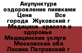 Акупунктура, оздоровление пиявками › Цена ­ 3 000 - Все города, Жуковский г. Медицина, красота и здоровье » Медицинские услуги   . Московская обл.,Лосино-Петровский г.